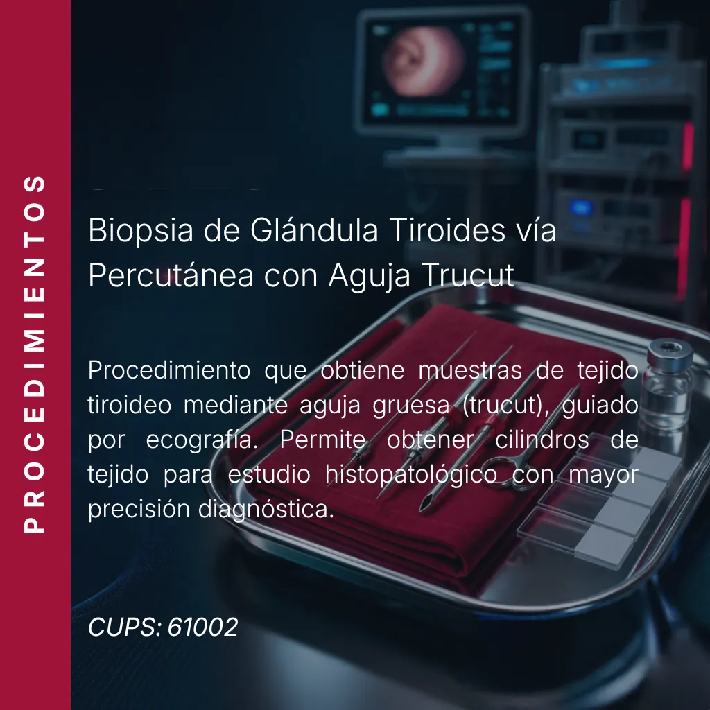 Biopsia de glándula tiroides vía percutánea con aguja trucut con precio en línea, centro aliado de MEI.