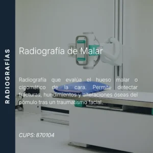 Radiografía de malar o hueso cigomático con precio en línea, centro de imagen aliado de MEI.