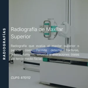 Radiografía de maxilar superior con precio en línea, centro de imagen aliado de MEI.