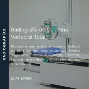 Radiografía de columna vertebral total con precio en línea, centro de imagen aliado de MEI.