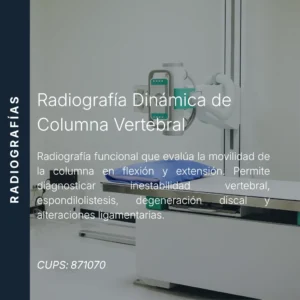 Radiografía dinámica de columna vertebral y precio en línea, centro de imagen aliado de MEI.