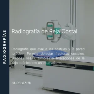Radiografía de reja costal con precio en línea, centro de imagen aliado de MEI.