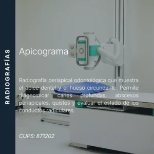 Apicograma o radiografía periapical odontológica con precio en línea, centro de imagen aliado de MEI.