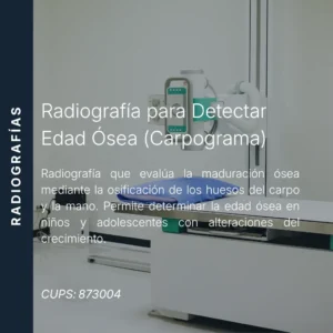Carpograma o radiografía para detectar edad ósea con precio en línea, centro aliado de MEI.
