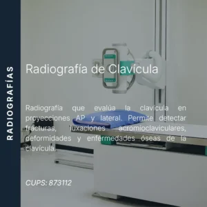Radiografía de clavícula con precio en línea, centro de imagen aliado de MEI.