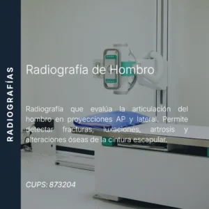 Radiografía de hombro en proyecciones AP y lateral con precio en línea, centro de imagen aliado de MEI.