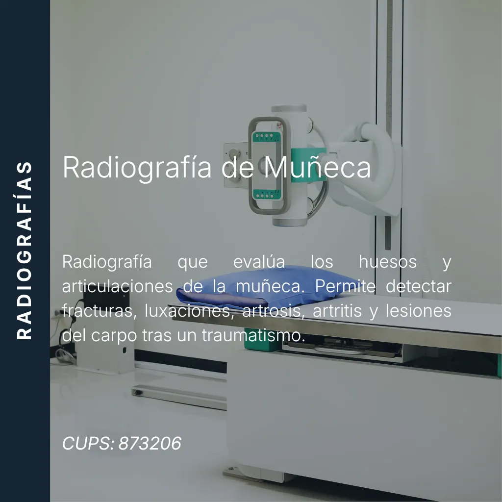 Radiografía de muñeca en proyecciones AP y lateral con precio en línea, centro aliado de MEI.