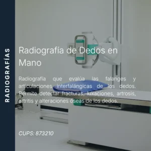 Radiografía de dedos en mano con precio en línea, centro de imagen aliado de MEI.