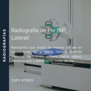 Radiografía de pie en proyecciones AP y lateral con precio en línea, centro de imagen aliado de MEI.