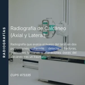 Radiografía de calcáneo en proyecciones axial y lateral con precio en línea, centro de imagen aliado de MEI.