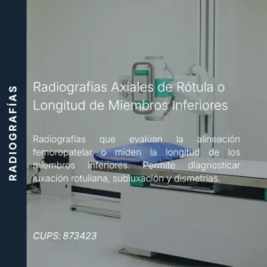 Radiografías axiales de rótula o longitud de miembros inferiores con precio en línea, centro aliado de MEI.