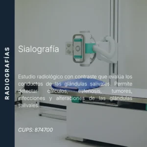 Sialografía de glándula salival con precio en línea, centro de imagen aliado de MEI.