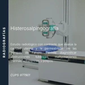 Histerosalpingografía con precio en línea, centro de imagen aliado de MEI.