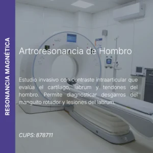 Artroresonancia de hombro con precio en línea, centro de imagen aliado de MEI.