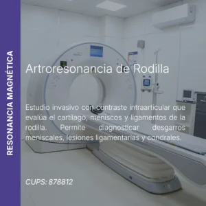 Artroresonancia de rodilla con precio en línea, centro de imagen aliado de MEI.