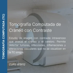 Tomografía computada de cráneo con contraste y precio en línea, centro de imagen aliado de MEI.