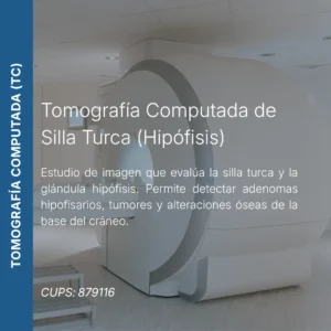 Tomografía computada de silla turca o hipófisis con precio en línea, centro aliado de MEI.