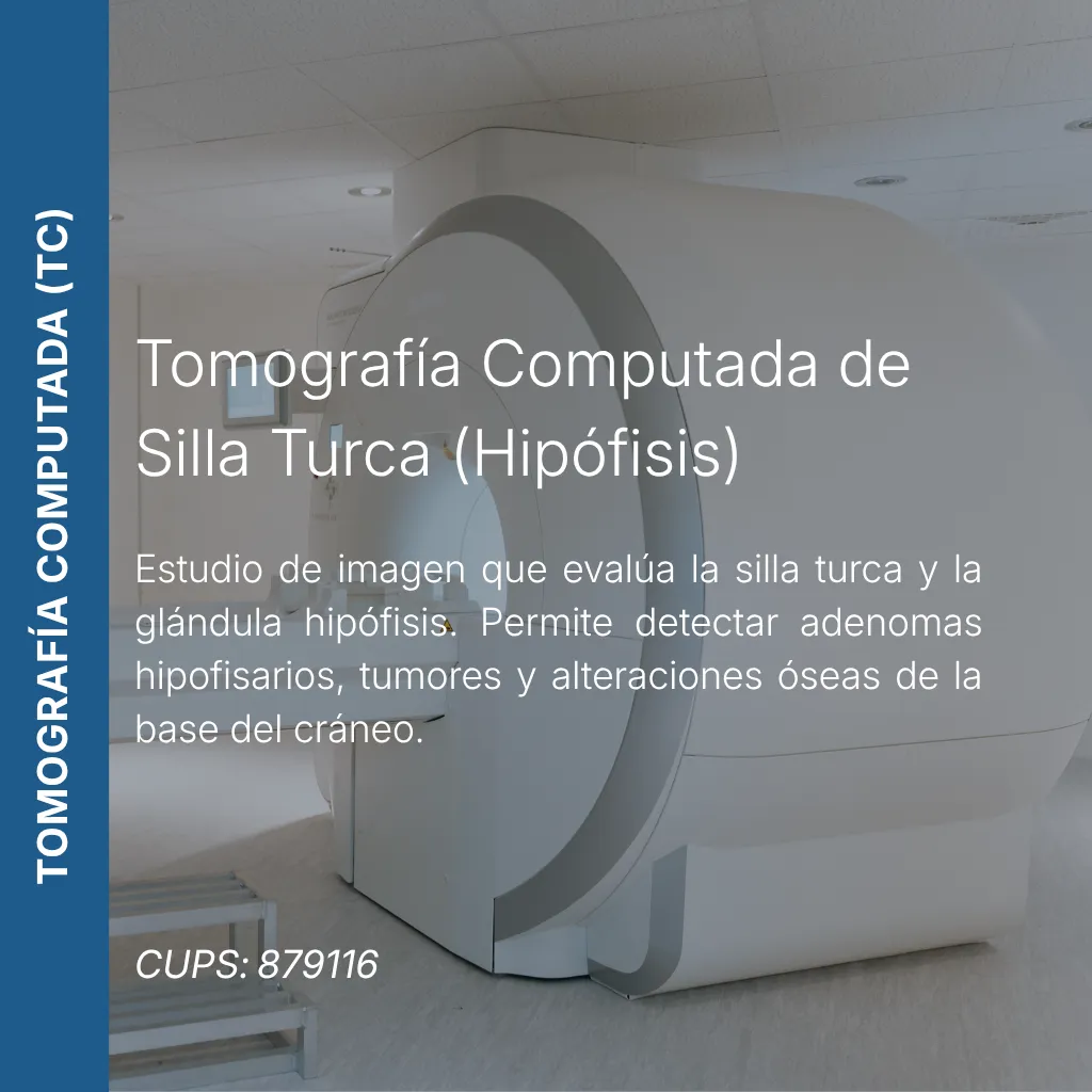 Tomografía computada de silla turca o hipófisis con precio en línea, centro aliado de MEI.