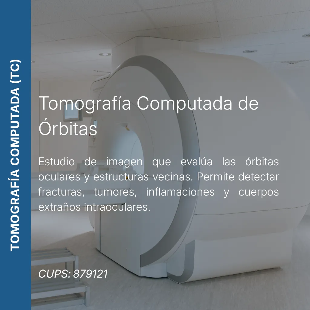 Tomografía computada de órbitas con precio en línea, centro de imagen aliado de MEI.