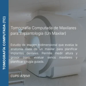Tomografía computada de maxilar para implantología con precio en línea, centro de imagen aliado de MEI.