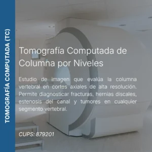 Tomografía computada de columna por niveles vertebrales con precio en línea, centro de imagen aliado de MEI.