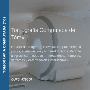 Tomografía computada de tórax con precio en línea, centro de imagen aliado de MEI.