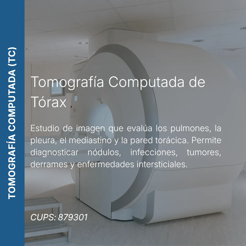 Tomografía computada de tórax con precio en línea, centro de imagen aliado de MEI.