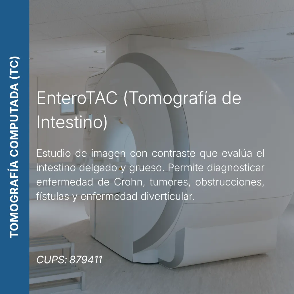 EnteroTAC, tomografía computada de intestino con precio en línea, centro de imagen aliado de MEI.