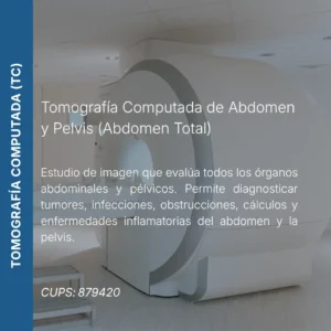 Tomografía computada de abdomen y pelvis (abdomen total) con precio en línea, centro aliado de MEI.