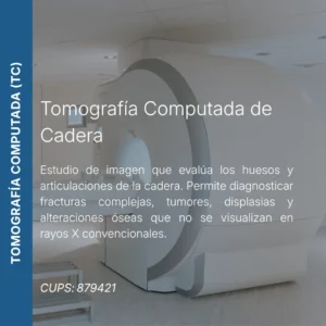Tomografía computada de cadera con precio en línea, centro de imagen aliado de MEI.