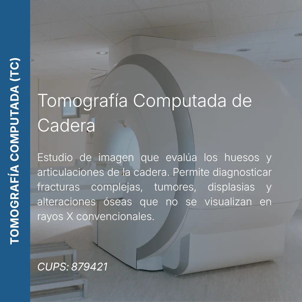 Tomografía computada de cadera con precio en línea, centro de imagen aliado de MEI.