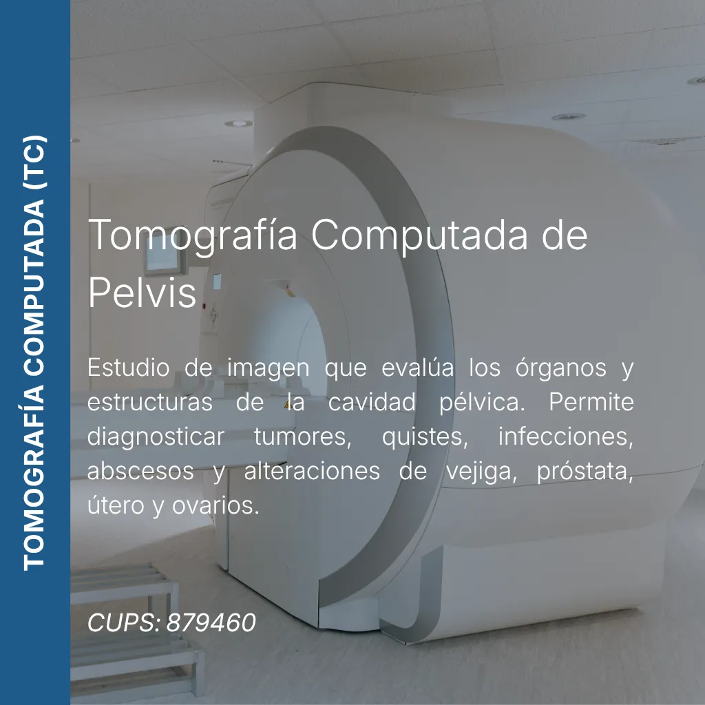 Tomografía computada de pelvis con precio en línea, centro de imagen aliado de MEI.