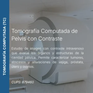 Tomografía computada de pelvis con contraste y precio en línea, centro de imagen aliado de MEI.