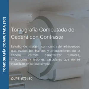 Tomografía computada de cadera con contraste y precio en línea, centro de imagen aliado de MEI.