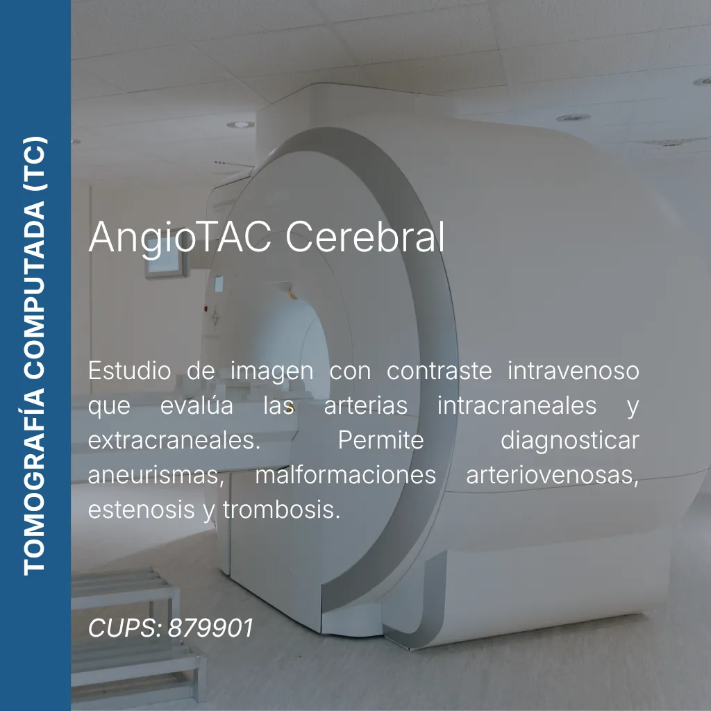 AngioTAC cerebral con precio en línea, centro de imagen aliado de MEI.