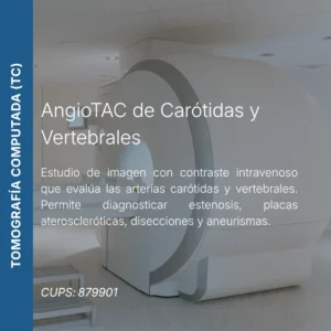 AngioTAC de carótidas y vertebrales con precio en línea, centro de imagen aliado de MEI.