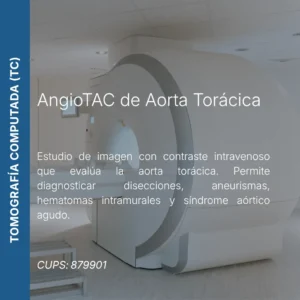 AngioTAC de aorta torácica con precio en línea, centro de imagen aliado de MEI.