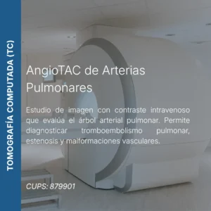 AngioTAC de arterias pulmonares con precio en línea, centro de imagen aliado de MEI.