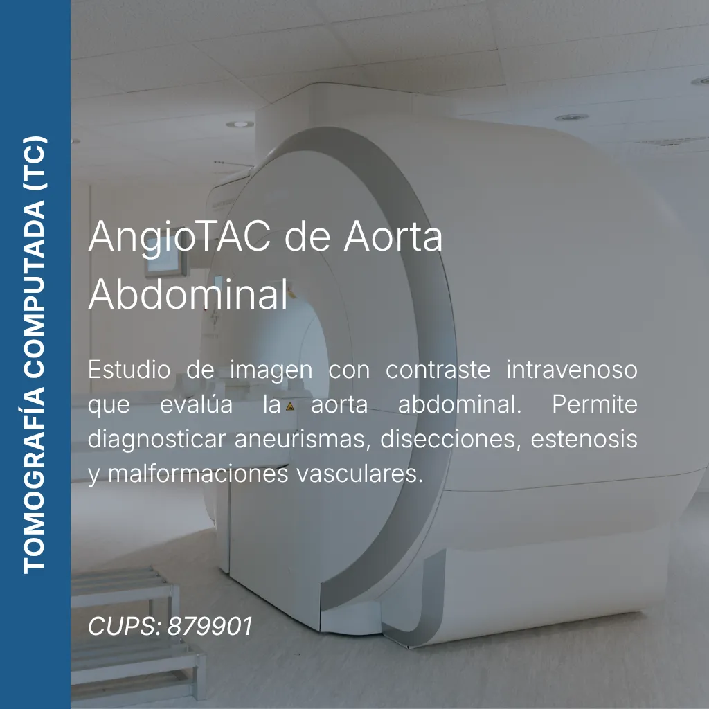 AngioTAC de aorta abdominal con precio en línea, centro de imagen aliado de MEI.