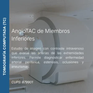 AngioTAC de miembros inferiores con precio en línea, centro de imagen aliado de MEI.