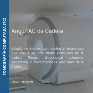 AngioTAC de cadera con precio en línea, centro de imagen aliado de MEI.