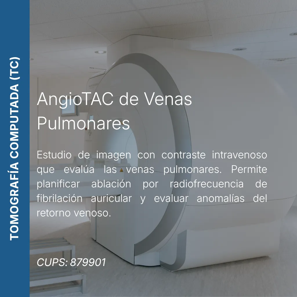 AngioTAC de venas pulmonares con precio en línea, centro de imagen aliado de MEI.