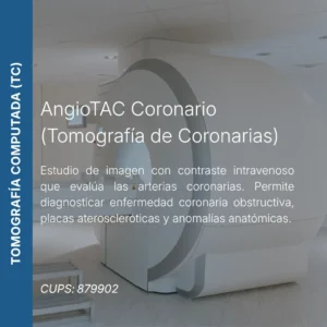 AngioTAC coronario o tomografía computada de coronarias con precio en línea, centro de imagen aliado de MEI.