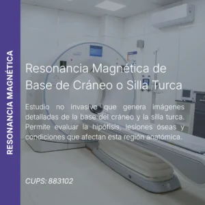 Resonancia magnética de base de cráneo o silla turca con precio en línea, centro de imagen aliado de MEI.