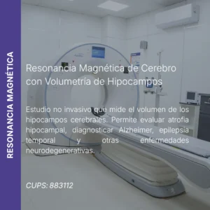 Resonancia magnética de cerebro con volumetría de hipocampos y precio en línea, centro aliado de MEI.