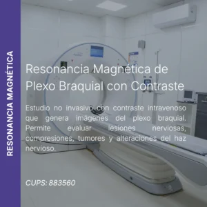 Resonancia magnética de plexo braquial con contraste y precio en línea, centro aliado de MEI.