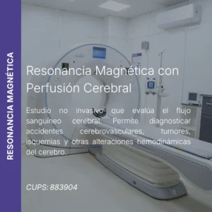 Resonancia magnética con perfusión cerebral y precio en línea, centro de imagen aliado de MEI.
