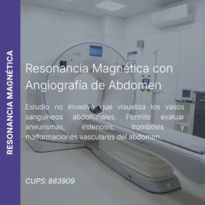 Resonancia magnética con angiografía de abdomen y precio en línea, centro de imagen aliado de MEI.