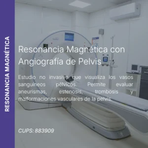 Resonancia magnética con angiografía de pelvis y precio en línea, centro de imagen aliado de MEI.