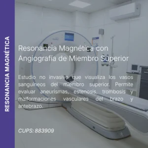 Resonancia magnética con angiografía de miembro superior y precio en línea, centro aliado de MEI.
